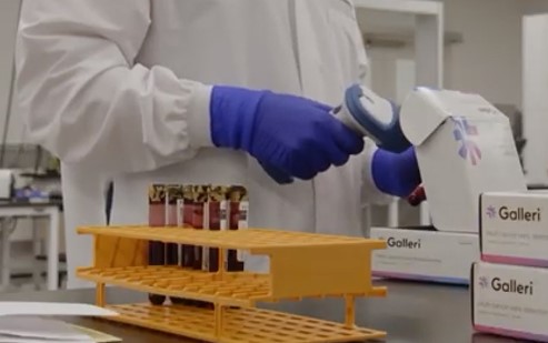 СТУДИЈА: Нов тест на крвта открива повеќе од 50 видови рак пред да се појават симптомите