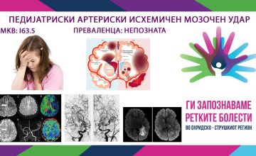Педијатриски артериски исхемичен мозочен удар ретка, но сериозна состојба, важна навремена реакција
