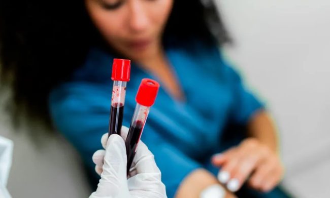 НОВ КРВЕН ТЕСТ СЕ ПОКАЖАЛ УСПЕШЕН ВО ОТКРИВАЊЕТО НА НАД 50 ВИДОВИ РАК