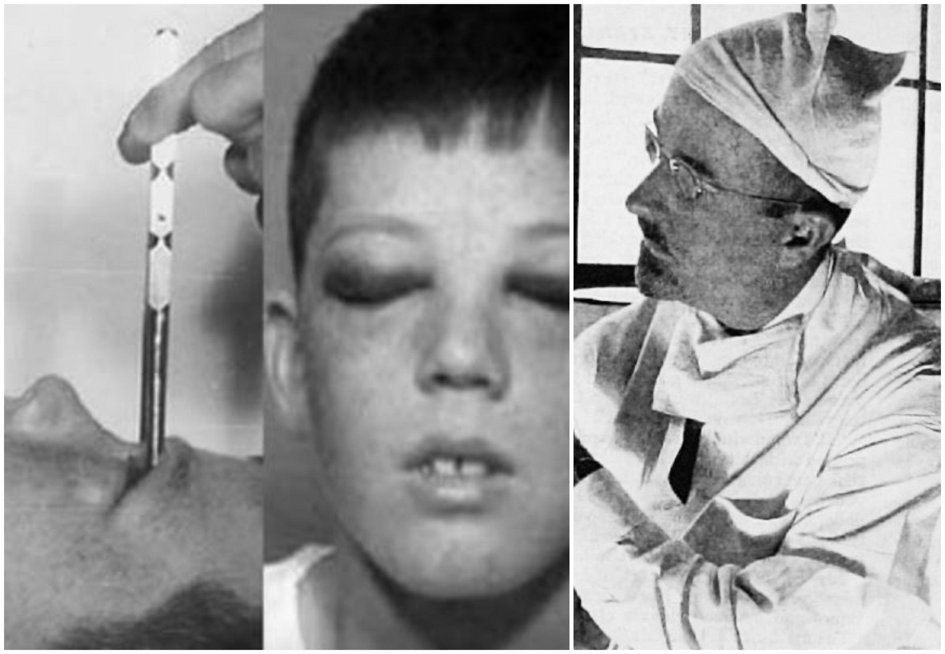 На 12 години, по инсистирање на маќеата, му била направена лоботомија: Докторот му туркал шило за мраз низ очните дупки и сè фотографирал — неговиот живот по тоа фасцинира