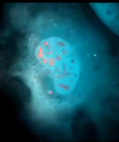 ВИДЕО: Погледајте како Т клетката убива клетка на ракот