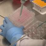 ЕЦДЦ предупредува на повторно ширење на мајмунски сипаници во Европа