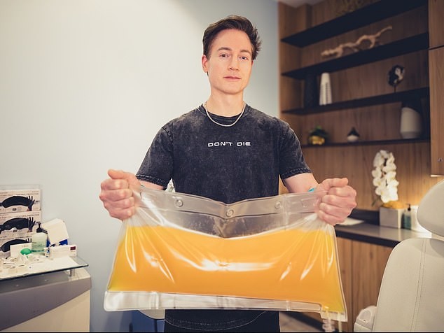 Супербогатите плаќаат илјадници евра за да ја „прочистат“ крвта од токсини и микропластика во очајниот обид за вечна младост