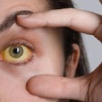 Три симптоми кои укажуваат на можни проблеми со црниот дроб