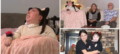 Девојка родена без голем мозок е медицинско чудо – прослави 20-ти роденден, лекарите ѝ предвидувале најмногу 4 години