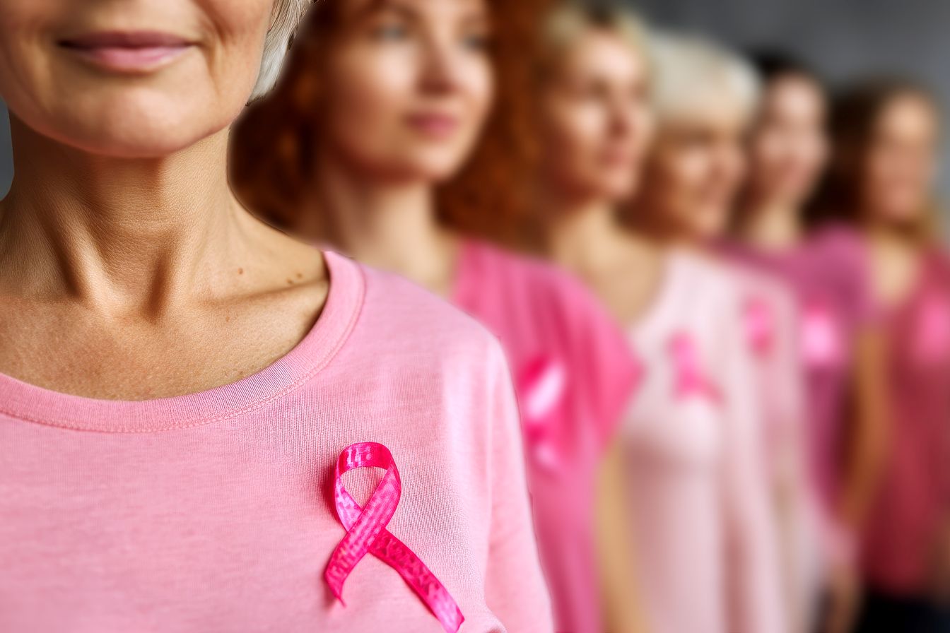 РАК НА ДОЈКА – ДЕЛ 2