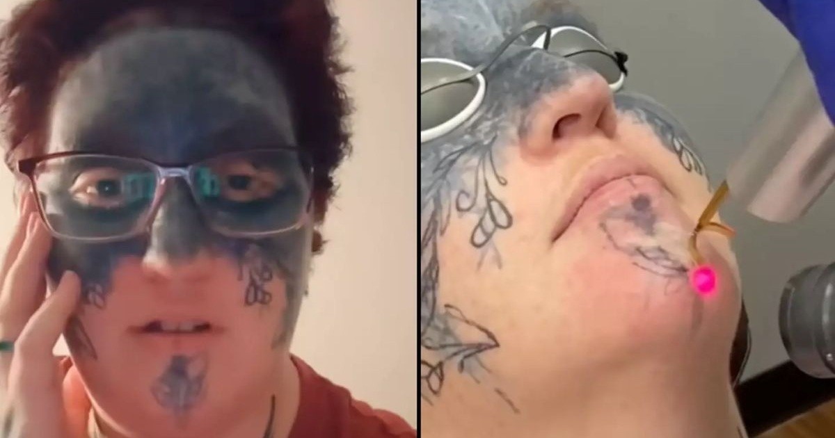 Шокантна исповед на жената на која присилно ѝ било истетовирано лицето: Водев долга и болна борба да ги отстранам тетоважите, а еве како изгледам по две години мачење