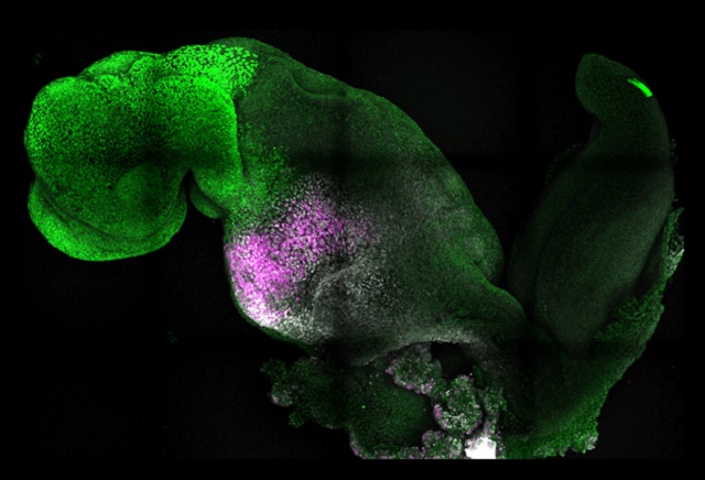 Научниците го мапираа развојот на мозочните клетки од ембрион до зрелост