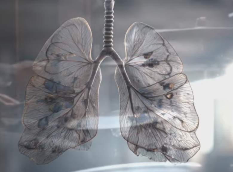 Бора Спужиќ Прогресив Квака