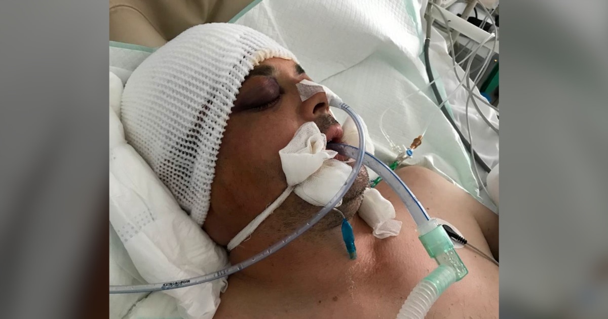 Насилна смрт на војник ги разоткрива проблемите со украинскиот воен кадар