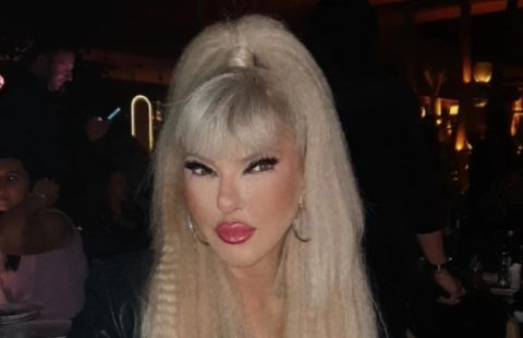 „Не сакам природно да стареам“ – Јами проговори за негативните искувства од естетските корекции