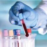 Британците работат на тест на крвта кој би можел да предвиди болести до 10 години однапред