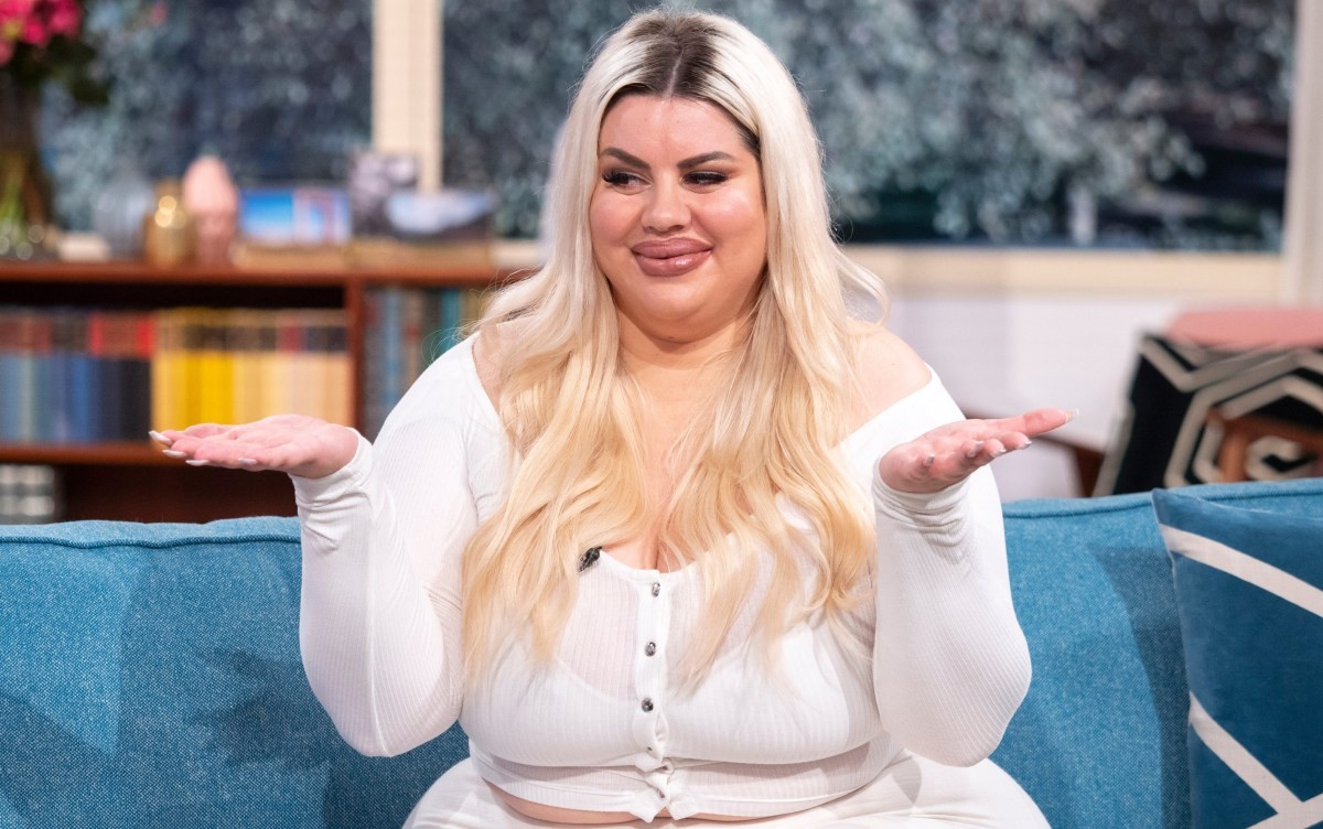 Потрошив 145.000 долари на естетски операции – еве како изгледав порано