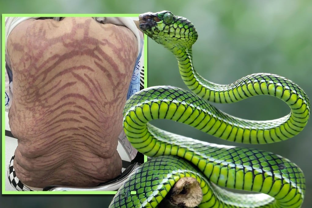 Кинеска жена со шокантна промена – по години користење традиционална кинеска медицина, кожата ѝ станала како на змија