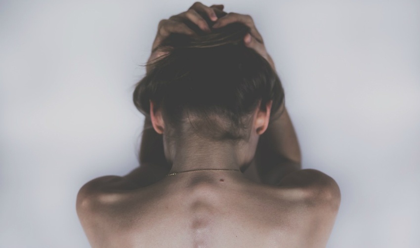 Симптоми што укажуваат дека имате аневризма на мозокот: Во секој момент може да пукне