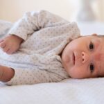 Егзема кај бебиња: Како да му помогнете на вашето дете