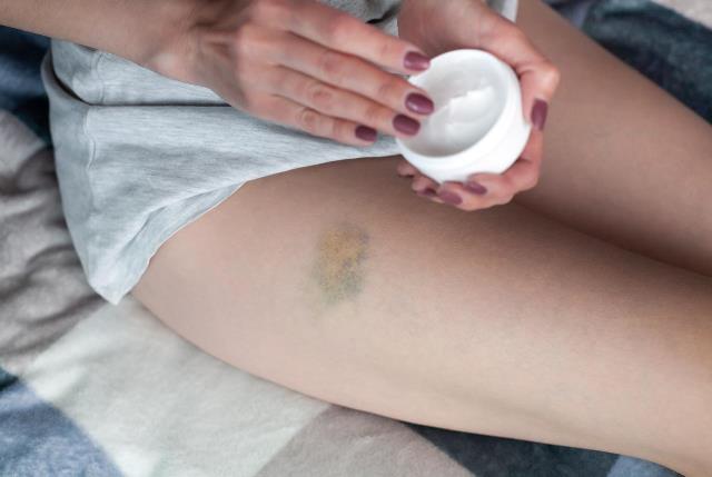 Ги брише модринките како гума: Оваа маска е природно чудо!