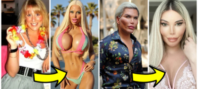 Инфекција на градите, нос со некроза: Морничавата вистина зад „живите барбики“