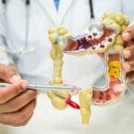 Овој додаток во исхраната драстично го намалува ризикот од неколку видови рак: Револуционерно откритие од научниците