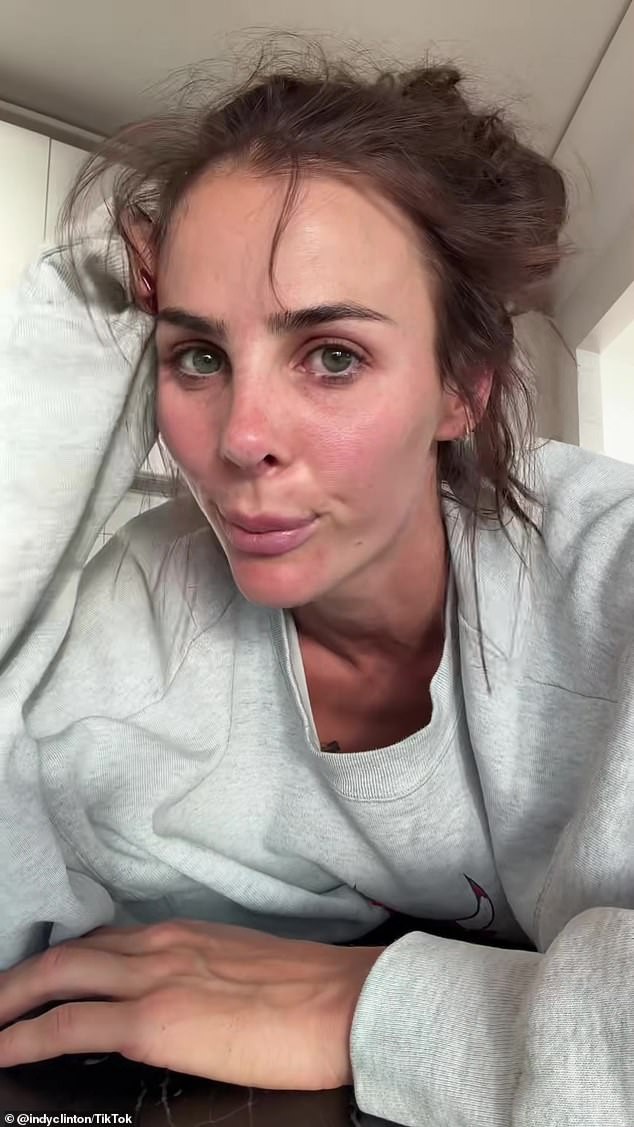 Инфлуенсерка од Австралија бара неверојатни суми од своите следбеници за да им го покаже носот по неуспешна операција