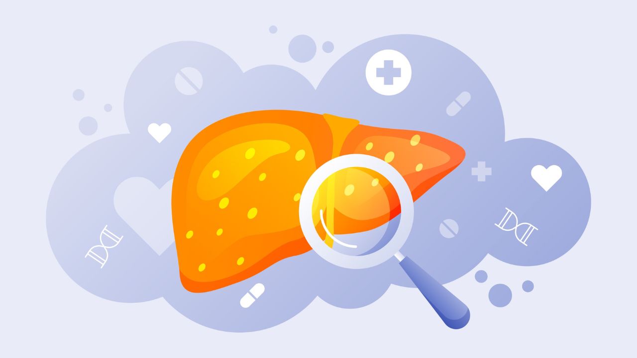 Како влијае ПОКАЧЕНИОТ ХОЛЕСТЕРОЛ врз црниот дроб?