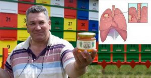 Докторите останале шокирани – со овој рецепт сам се излекувал од рак на белите дробови