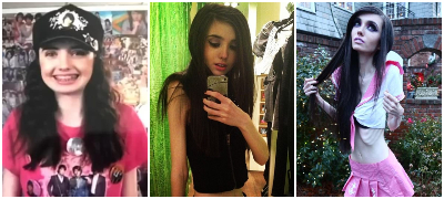 Нема ни 40 kg, почна да се крие од јавност: Тажната приказна на анорексичната инфлуенсерка Евгенија Куни