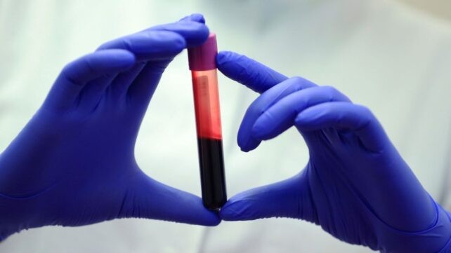 Крвта на луѓето што живеат 100 години е различна од сите други и открива тајни за долговечноста – дали ќе најдеме еликсир за вечна младост?