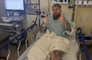 Џејк Пол успешно опериран по нокаутот од Џошуа: Имам две титаниумски плочи од двете страни на вилицата