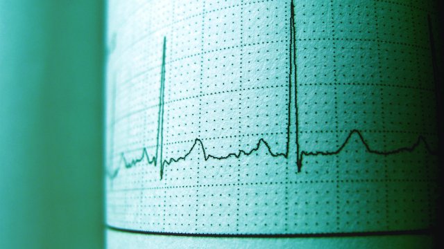 Доктор: 90 проценти од срцевите удари започнуваат со една утринска навика