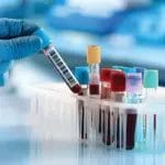 Што се крие во крвта на најстарите луѓе во светот: Дали ова е клучот за долговечноста?