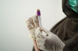 ШТО ДА ЈАДЕТЕ ДЕН ПРЕД ВАДЕЊЕТО НА КРВ? Многумина ги прават ОВИЕ ГРЕШКИ кои влијаат на наодот!