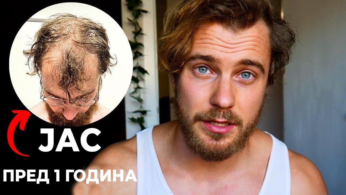 Како го спречив ќелавењето: Што направив пред да биде предоцна