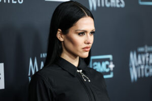 Позната манекенка ја открива вистината за пластичните операции: „Тоа беше најлошото нешто во мојот живот“