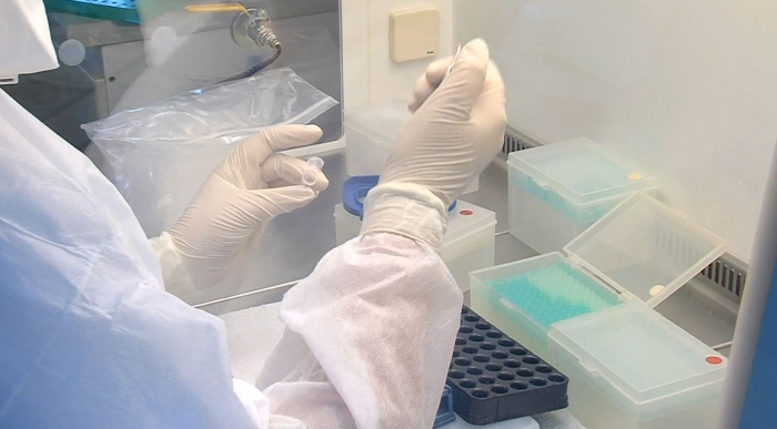 Прв смртен случај со грип оваа сезона – почина 75 годишна жена на Инфективна