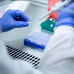 Саудијците го одобрија лекот на д-р Шионг за лекување на најраширениот рак на белите дробови