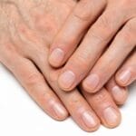 Не ги игнорирајте овие промени на ноктите бидејќи тие би можеле да укажуваат на болест