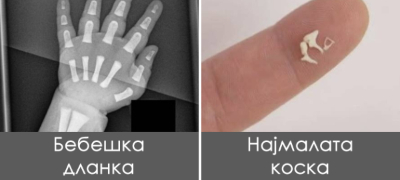 Дехидрирана крв, пресадена рожница: Фотки кои покажуваат колку е чудно човечкото тело