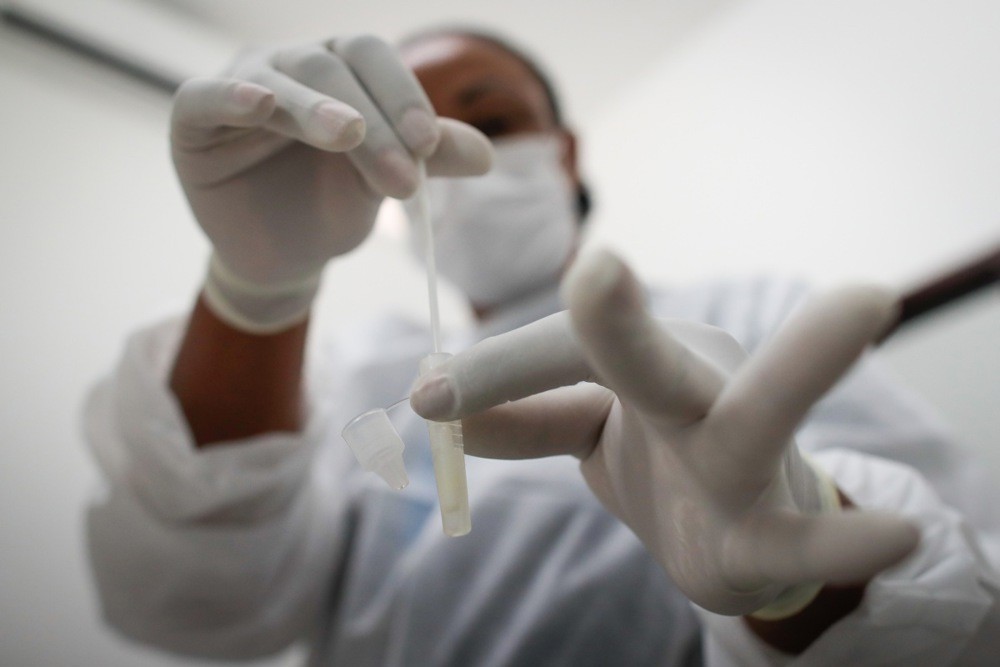 СЗО: Низок ризик од ширење на вирусот нипах надвор од Индија