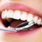 Два домашни рецепти кои помагаат во отстранување на каменец од забите!