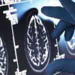 Мозочните игри можат значително да го намалат ризикот од деменција и Алцхајмерова болест