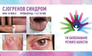 Ги запознаваме ретките болести: СЈОГРЕНОВ СИНДРОМ