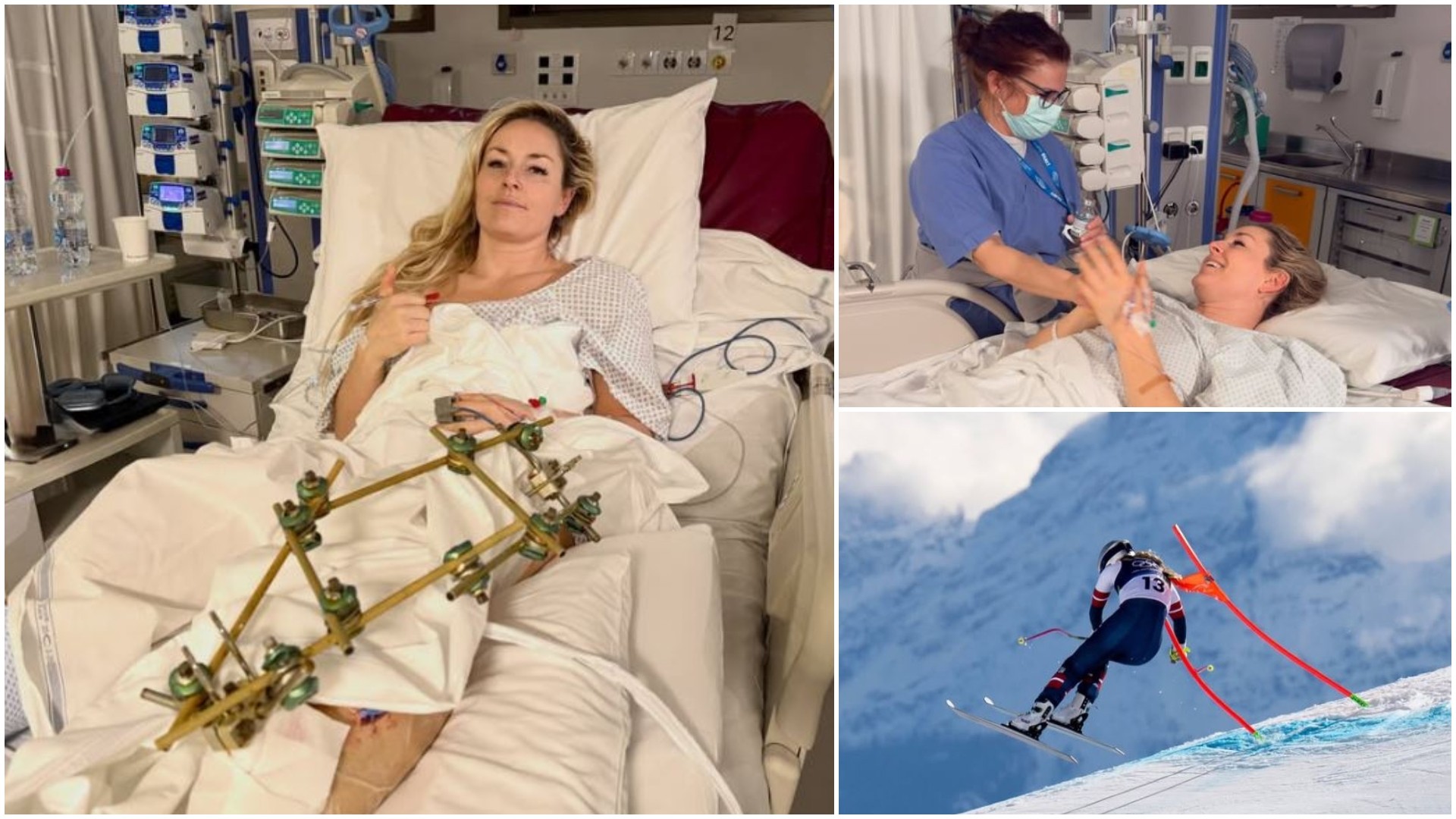 Вон објави фотографии од болница по падот на ЗОИ: „Успехот денес за мене има сосема поинакво значење отколку што имаше пред неколку дена“