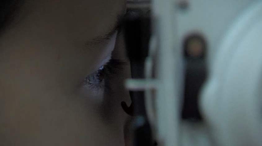 Голем град, но малку специјалисти за пациентите – во велешката болница фалат офталмолози и физијатри