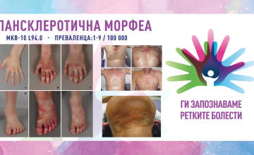 Ги запознаваме ретките болести: ПАНСКЛЕРОТИЧНА МОРФЕА