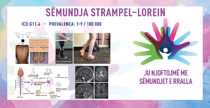 ГИ ЗАПОЗНАВАМЕ РЕТКИТЕ БОЛЕСТИ: СТРАМПЕЛ–ЛОРЕИНОВА БОЛЕСТ