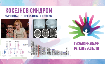Ги запознаваме ретките болести: КОКЕЈНОВ СИНДРОМ