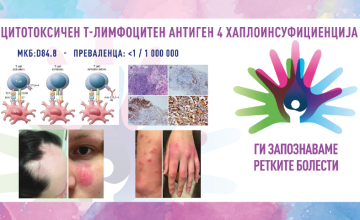 Ги запознаваме ретките болести: ЦИТОТОКСИЧЕН Т-ЛИМФОЦИТЕН АНТИГЕН 4 ХАПЛОИНСУФИЦИЕНЦИЈА