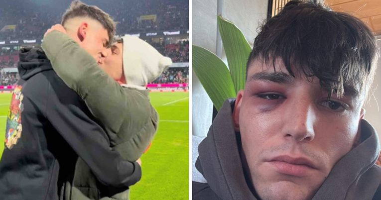 Брутално претепан судијата кој го запроси момчето пред 50.000 гледачи во Бундеслигата!