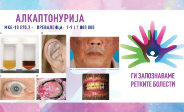 Ги запознаваме ретките болести: АЛКАПТОНУРИЈА